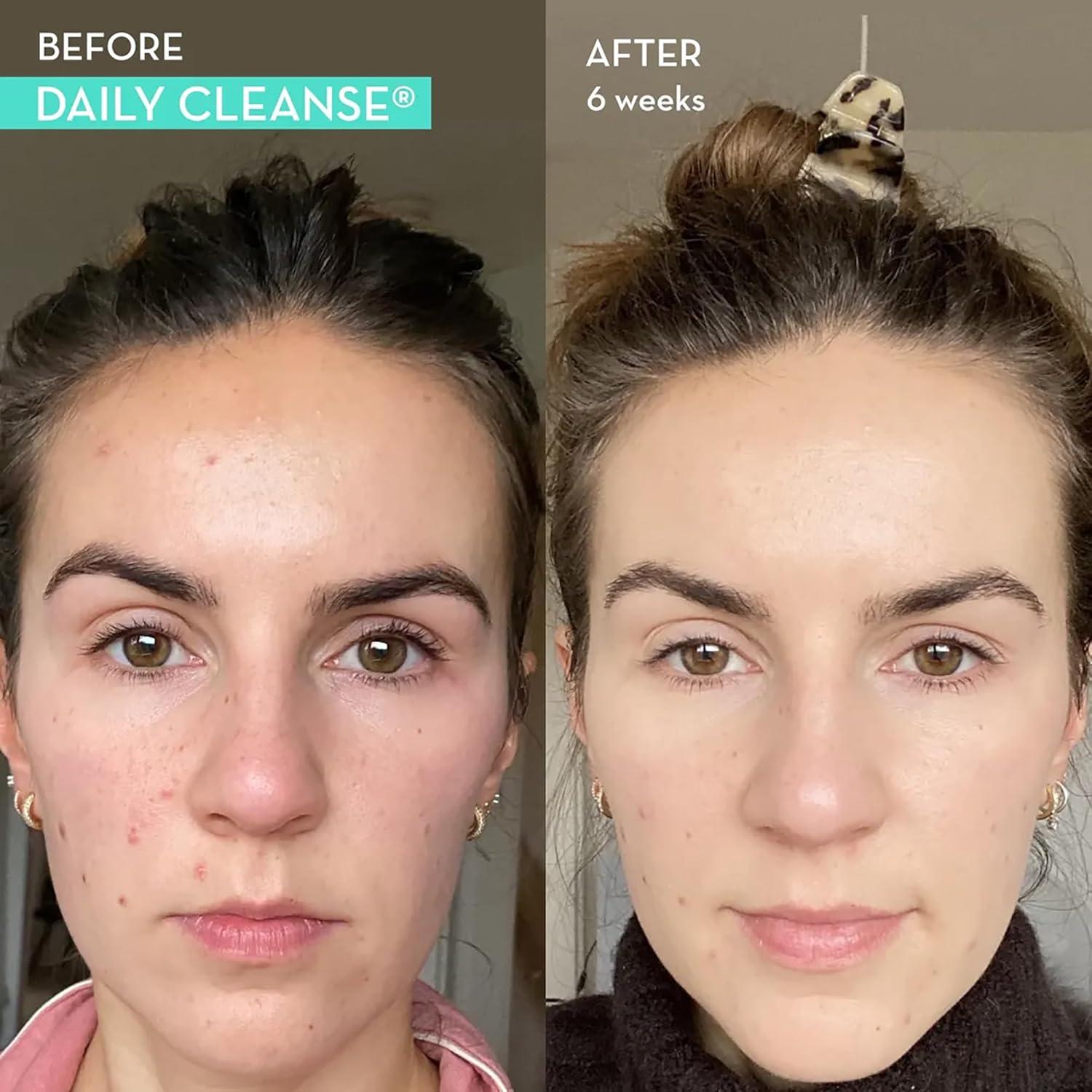 imageHUM Digest and Detox Flatter Me 18 Digestive Enzymes to Support Food Breakdown and Daily Cleanse Detoxifying Herbs and Organic Alage Supports a Natural Detox and Clear Skin