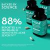 HUM Full Skin Detox and Cleanse -Proboitics for Problem Skin and Acne Breakouts witrh Organic Algae, Detoxifying Herbs, Skin Squad and Daily Cleanse